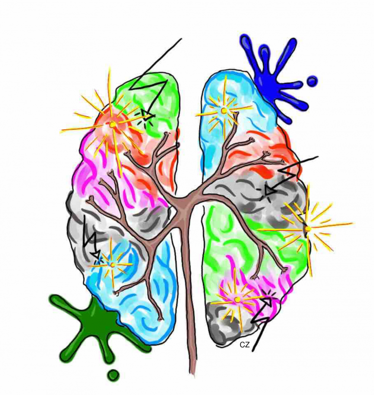 Neurodiversität als Herausforderung